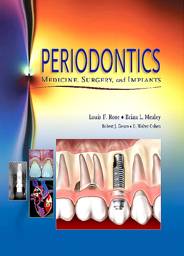 Periodontics: Medicine, Surgery and Implants