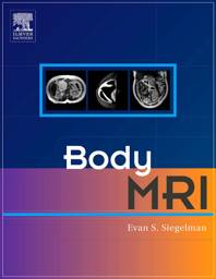 Body MRI