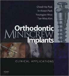 Orthodontic Miniscrew Implants