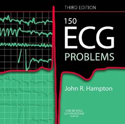 150 ECG Problems, 3rd Edition, international Edition