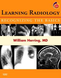 Learning Radiology: Recognizing the Basics: With STUDENT CONSULT Online Access