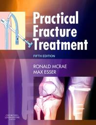 Practical Fracture Treatment, International Edition, 5th Edition
