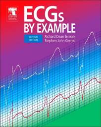 ECGs by Example, Edition 2