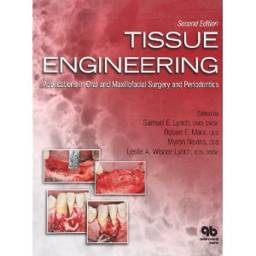 Tissue Engineering: Applications in Oral and Maxillofacial Surgery and Periodontics, 2nd edition