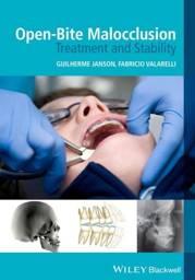 Open-Bite Malocclusion: Treatment and Stability