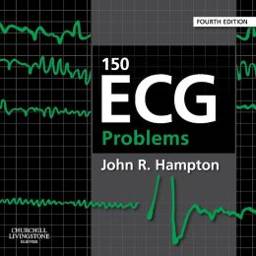150 ECG Problems, International Edition, 4th Edition