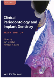 Clinical Periodontology and Implant Dentistry, 2 Volume Set 6th Edition
