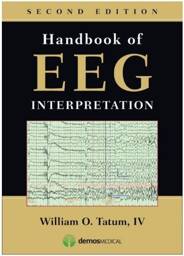 Handbook of EEG Interpretation, 2nd Ed