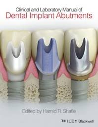 Clinical and Laboratory Manual of Dental Implant Abutments, 1st Edition