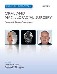 Challenging Concepts in Oral and Maxillofacial Surgery, 1st Edition