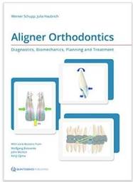 Aligner Orthodontics: Diagnostics, Biomechanicals, Planning and Treatment