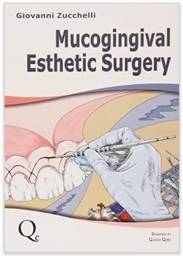 Mucogingival Esthetic Surgery 2 Vol Set, 1st Edition