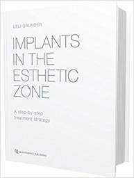 Implants in the Esthetic Zone: A Step-by-Step Treatment Strategy, 1st Edition