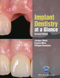 Implant Dentistry at a Glance, 2nd Edition