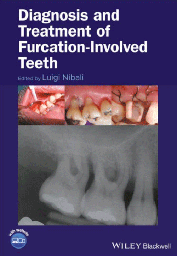 Diagnosis and Treatment of Furcation-Involved Teeth, 1st Edition