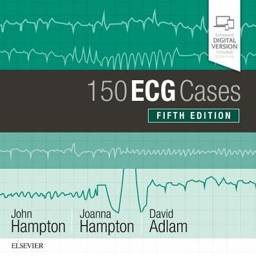 150 ECG Cases, International Edition, 5th Edition