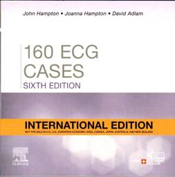 160 ECG Cases