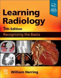 Learning Radiology, 9780323878173