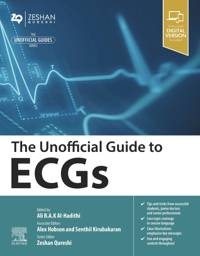 The Unofficial Guide to ECGs