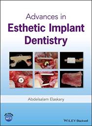 Advances in Esthetic Implant Dentistry, 1st Edition
