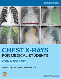 Chest-X-Rays-for-Medical-Students-CXRs-Made-Easy-9781119504153.jpg