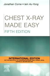 Chest X-Ray Made Easy