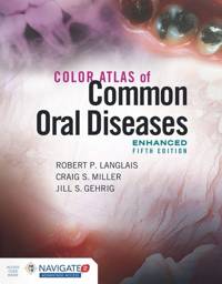 Color Atlas of Common Oral Diseases