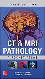 ct-and-mri-pathology-a-pocket-atlas-third-edition-9781260121940