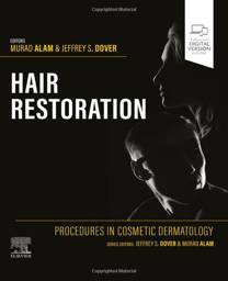 Procedures in Cosmetic Dermatology: Hair Restoration