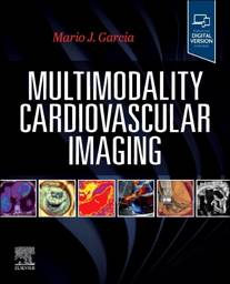 Multimodality Cardiovascular Imaging, 1st Edition