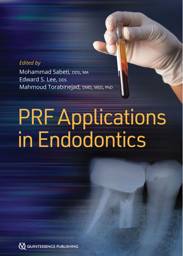 PRF-Applications-in-Endodontics-9780867158274